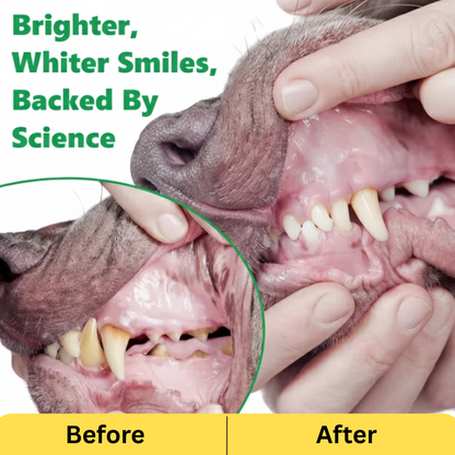 Dental Powder